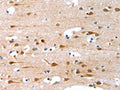 The image on the left is immunohistochemistry of paraffin-embedded Human brain tissue using CSB-PA052274(ALS2CR11 Antibody) at dilution 1/30, on the right is treated with fusion protein. (Original magnification: ×200)