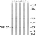 Western blot analysis of extracts from Jurkat cells, HeLa cells, HepG2 cells and MCF-7 cells, using NDUFV2 antibody.