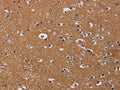 The image on the left is immunohistochemistry of paraffin-embedded Human brain tissue using CSB-PA052500(NRAS Antibody) at dilution 1/30, on the right is treated with synthetic peptide. (Original magnification: ×200)
