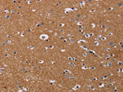 The image on the left is immunohistochemistry of paraffin-embedded Human brain tissue using CSB-PA052500(NRAS Antibody) at dilution 1/30, on the right is treated with synthetic peptide. (Original magnification: ×200)
