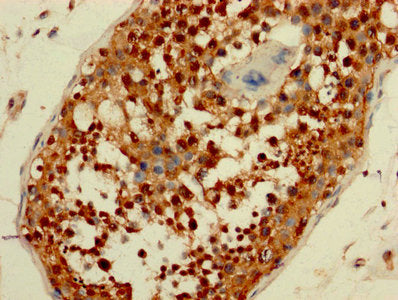 IHC image of CSB-PA05264A0Rb diluted at 1:200 and staining in paraffin-embedded human testis tissue performed on a Leica BondTM system. After dewaxing and hydration, antigen retrieval was mediated by high pressure in a citrate buffer (pH 6.0). Section was blocked with 10% normal goat serum 30min at RT. Then primary antibody (1% BSA) was incubated at 4&deg;C overnight. The primary is detected by a biotinylated secondary antibody and visualized using an HRP conjugated SP system.