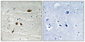 Immunohistochemical analysis of paraffin-embedded human brain tissue using MDC1 (Phospho-Ser513) antibody (left)or the same antibody preincubated with blocking peptide (right).