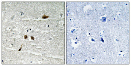 Immunohistochemical analysis of paraffin-embedded human brain tissue using MDC1 (Phospho-Ser513) antibody (left)or the same antibody preincubated with blocking peptide (right).