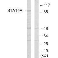 Western blot analysis of extracts from 293 cells, using STAT5A antibody.