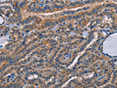STRADB Antibody – Figure 1 of 2