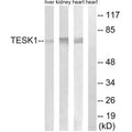 Western blot analysis of extracts from rat heart cells, rat kidney cells and rat liver cells, using TESK1 antibody.