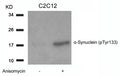 Western blot analysis of extracts from C2C12 cells untreated or treated with Anisomycin using a-Synuclein(Phospho-Tyr133) Antibody.