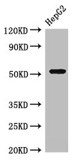 Western Blot
Positive WB detected in: HepG2 whole cell lysate
All lanes: GSK3A antibody at 3µg/ml
Secondary
Goat polyclonal to rabbit IgG at 1/50000 dilution
Predicted band size: 51 kDa
Observed band size: 51 kDa