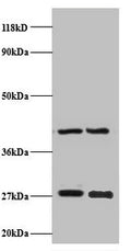 Western blot
All lanes: NDUFV2 antibody at 2µg/ml
Lane 1: EC109 whole cell lysate
Lane 2: 293T whole cell lysate
Secondary
Goat polyclonal to rabbit IgG at 1/15000 dilution
Predicted band size: 28 kDa
Observed band size: 28 kDa