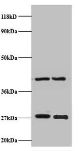 Western blot
All lanes: NDUFV2 antibody at 2µg/ml
Lane 1: EC109 whole cell lysate
Lane 2: 293T whole cell lysate
Secondary
Goat polyclonal to rabbit IgG at 1/15000 dilution
Predicted band size: 28 kDa
Observed band size: 28 kDa