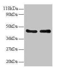 Western blot
All lanes: AHSA1 antibody at 2µg/ml
Lane 1: EC109 whole cell lysate
Lane 2: 293T whole cell lysate
Secondary
Goat polyclonal to rabbit IgG at 1/15000 dilution
Predicted band size: 39, 33 kDa
Observed band size: 45 kDa