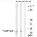 Western blot analysis of extracts from Jurkat cells and COLO cells, using TRAPPC3 antibody.