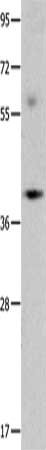 Gel: 10%SDS-PAGE, Lysate: 40 ug, Lane: Mouse brain tissue, Primary antibody: CSB-PA055401(OPCML Antibody) at dilution 1/400, Secondary antibody: Goat anti rabbit IgG at 1/8000 dilution, Exposure time: 1 minute