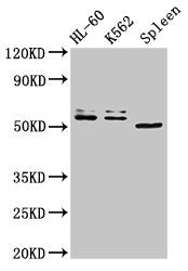 Western Blot
Positive WB detected in: HL60 whole cell lysate, K562 whole cell lysate, Mouse spleen tissue
All lanes: API5 antibody at 3ug/ml
Secondary
Goat polyclonal to rabbit IgG at 1/50000 dilution
Predicted band size: 60, 50, 57, 51, 58 kDa
Observed band size: 60, 50 kDa
