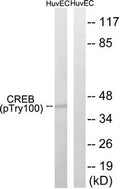 Western blot analysis of extracts from HUVEC cells, treated with etoposide (25uM, 24hours), using CREB (Phospho-Thr100) antibody. The lane on the right is treated with the synthesized peptide.