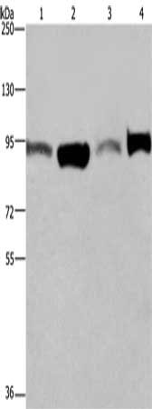 Gel: 6%SDS-PAGE, Lysate: 40 ug, Lane 1-4: A375 cells, LoVo cells, human testis tissue, Hela cells, Primary antibody: CSB-PA056223(ELAC2 Antibody) at dilution 1/250, Secondary antibody: Goat anti rabbit IgG at 1/8000 dilution, Exposure time: 30 seconds