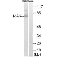 Western blot analysis of extracts from K562 cells, using MAK (Ab-159) antibody.