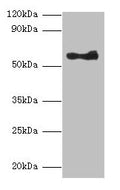 Western blot
All lanes: ANGPT1 antibody at 2µg/ml + A549 whole cell lysate
Secondary
Goat polyclonal to rabbit lgG at 1/10000 dilution
Predicted bands size: 58 kDa
Observed bands size: 58 kDa