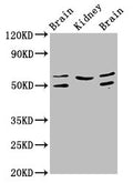 Western Blot
Positive WB detected in: Rat brain tissue, Rat kidney tissue, Mouse brain tissue
All lanes: ANGPT2 antibody at 3.2µg/ml
Secondary
Goat polyclonal to rabbit IgG at 1/50000 dilution
Predicted band size: 57, 51 kDa
Observed band size: 57, 51 kDa