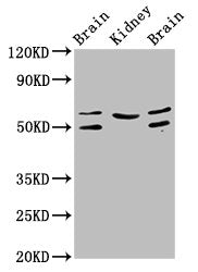Western Blot
Positive WB detected in: Rat brain tissue, Rat kidney tissue, Mouse brain tissue
All lanes: ANGPT2 antibody at 3.2µg/ml
Secondary
Goat polyclonal to rabbit IgG at 1/50000 dilution
Predicted band size: 57, 51 kDa
Observed band size: 57, 51 kDa