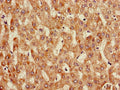 Immunohistochemistry of paraffin-embedded human liver tissue using CSB-PA05759A0Rb at dilution of 1:100