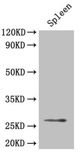 Western Blot
Positive WB detected in: Mouse spleen tissue
All lanes: BDNF antibody at 4µg/ml
Secondary
Goat polyclonal to rabbit IgG at 1/50000 dilution
Predicted band size: 28, 29, 30, 38, 32 kDa
Observed band size: 28 kDa