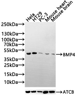 Western Blot
Positive WB detected in: Hela whole cell lysate(30µg), HT29 whole cell lysate(30µg), PC-3 whole cell lysate(30µg), Mouse Heart tissue lysate(30µg),Mouse Brain tissue lysate(30µg)
All lanes: BMP4 antibody at 1:1000
Secondary
Goat polyclonal to rabbit IgG at 1/20000 dilution
Predicted band size: 47 kDa
Observed band size: 47 kDa
Exposure time: 120s