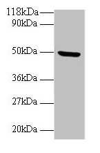Western blot
All lanes: BMP7 antibody at 2µg/ml + Mouse kidney tissue
Secondary
Goat polyclonal to rabbit IgG at 1/10000 dilution
Predicted band size: 50 kDa
Observed band size: 50 kDa