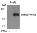 Western blot analysis of extracts from Hela cells untreated or treated with IFN-a  using Stat2(phospho-Tyr690) Antibody.