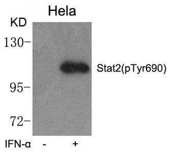 Western blot analysis of extracts from Hela cells untreated or treated with IFN-a  using Stat2(phospho-Tyr690) Antibody.