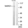 Western blot analysis of extracts from HUVEC cells, using NARG1 antibody.