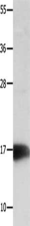 Gel: 12%SDS-PAGE, Lysate: 40 ug, Lane: Mouse kidney tissue, Primary antibody: CSB-PA058575(NME3 Antibody) at dilution 1/800, Secondary antibody: Goat anti rabbit IgG at 1/8000 dilution, Exposure time: 1 minute