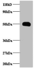 Western blot
All lanes: CCL2 antibody at 2µg/ml + EC109 whole cell lysate
Secondary
Goat polyclonal to rabbit IgG at 1/15000 dilution
Predicted band size: 12 kDa
Observed band size: 50 kDa
