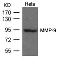 Western blot analysis of extracts from Hela cells using MMP-9 Antibody.