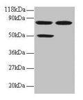 Western blot
All lanes: CCL22 antibody at 2µg/ml
Lane 1: 293T whole cell lysate
Lane 2: EC109 whole cell lysate
Secondary
Goat polyclonal to rabbit IgG at 1/15000 dilution
Predicted band size: 11 kDa
Observed band size: 50, 80 kDa
