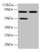 Western blot
All lanes: CCL22 antibody at 2µg/ml
Lane 1: 293T whole cell lysate
Lane 2: EC109 whole cell lysate
Secondary
Goat polyclonal to rabbit IgG at 1/15000 dilution
Predicted band size: 11 kDa
Observed band size: 50, 80 kDa
