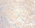 Immunohistochemistry of paraffin-embedded human lymph node tissue using CSB-PA05909A0Rb at dilution of 1:100