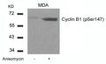 Western blot analysis of extracts from MDA cells untreated or treated with Anisomycin using Cyclin B1(phospho-Ser147) Antibody.