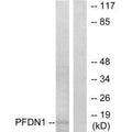 Western blot analysis of extracts from RAW264.7 cells, using PFDN1 antibody.