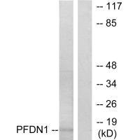 Western blot analysis of extracts from RAW264.7 cells, using PFDN1 antibody.