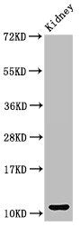 Western Blot
Positive WB detected in: Mouse kidney tissue
All lanes: CCL3 antibody at 3ug/ml
Secondary
Goat polyclonal to rabbit IgG at 1/50000 dilution
Predicted band size: 11 kDa
Observed band size: 11 kDa