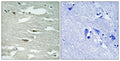Immunohistochemical analysis of paraffin-embedded human brain tissue using ILK (Phospho-Ser246) antibody (left)or the same antibody preincubated with blocking peptide (right).