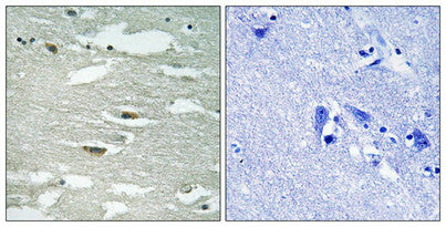 Immunohistochemical analysis of paraffin-embedded human brain tissue using ILK (Phospho-Ser246) antibody (left)or the same antibody preincubated with blocking peptide (right).