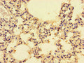 Immunohistochemistry of paraffin-embedded human lung tissue using CSB-PA05949A0Rb at dilution of 1:100