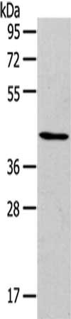 Gel: 8%SDS-PAGE,Lysate: 40 ug,,Primary antibody: CSB-PA059522(RUNX2 Antibody) at dilution 1/105 dilution,Secondary antibody: Goat anti rabbit IgG at 1/8000 dilution,Exposure time: 2 minutes