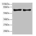Western blot
All lanes: CCL5 antibody at 2µg/ml
Lane 1: EC109 whole cell lysate
Lane 2: 293T whole cell lysate
Secondary
Goat polyclonal to rabbit IgG at 1/15000 dilution
Predicted band size: 10 kDa
Observed band size: 70 kDa
