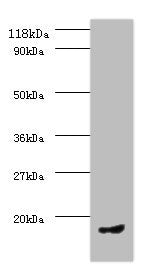 Western blot
All lanes: CCL5 antibody at 2µg/ml + PMBC whole cell lysate
Secondary
Goat polyclonal to rabbit IgG at 1/10000 dilution
Predicted band size: 10 kDa
Observed band size: 10 kDa