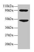 Western blot
All lanes: CCL7 antibody at 2µg/ml + 293T whole cell lysate
Secondary
Goat polyclonal to rabbit IgG at 1/15000 dilution
Predicted band size: 12 kDa
Observed band size: 48, 90 kDa