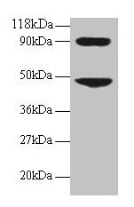Western blot
All lanes: CCL7 antibody at 2µg/ml + 293T whole cell lysate
Secondary
Goat polyclonal to rabbit IgG at 1/15000 dilution
Predicted band size: 12 kDa
Observed band size: 48, 90 kDa