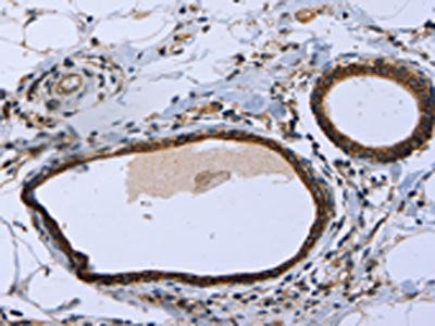 MAPRE3 Antibody – Figure 1 of 3